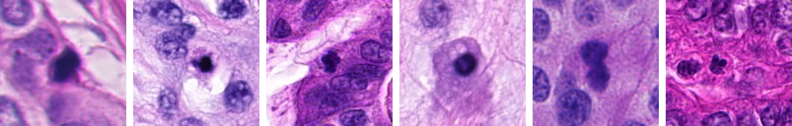 Six look-alikes from MIDOG++ training slides: dark nuclei the experts labeled as not mitotic.