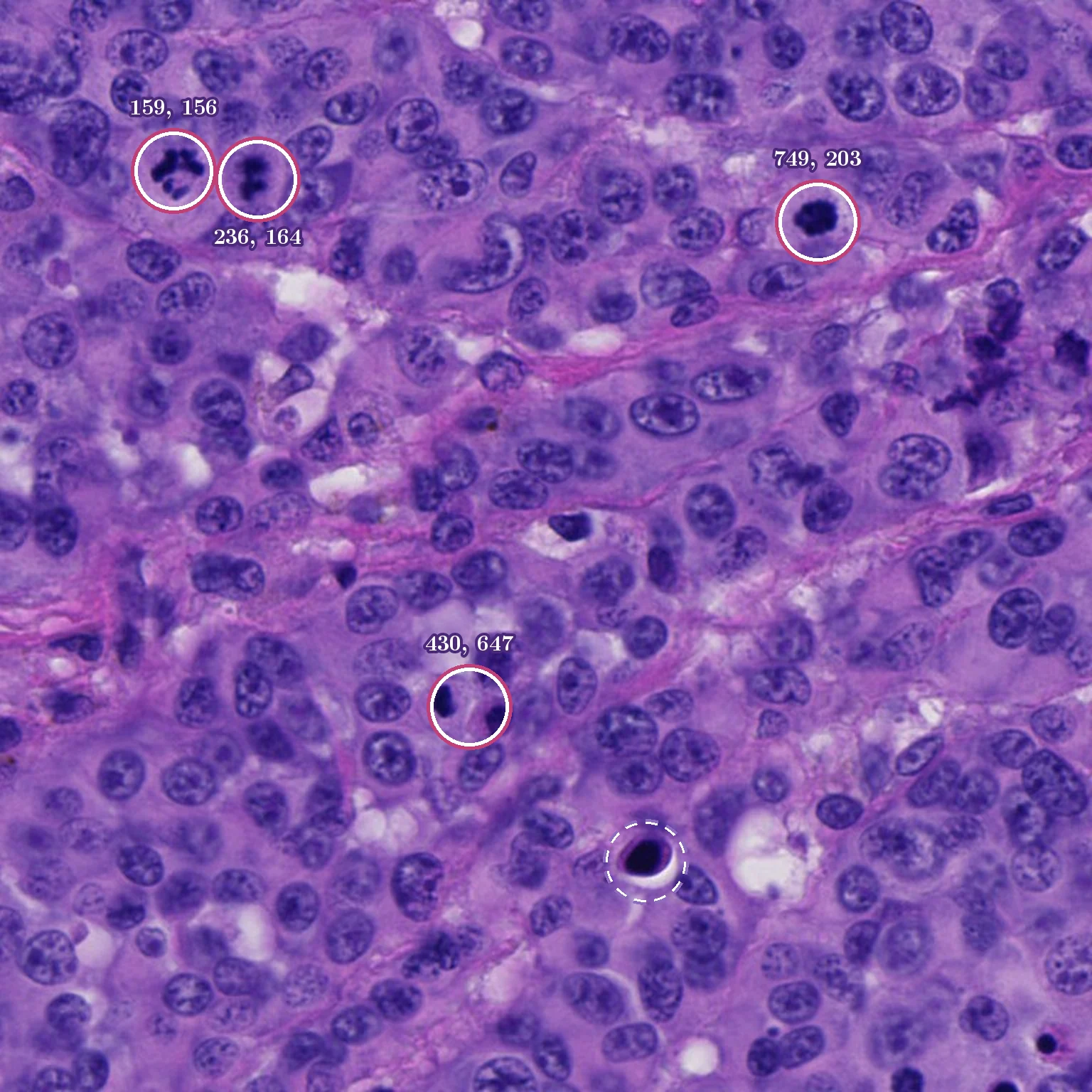 The same field with each expert-labeled mitotic figure ringed at the 30 pixel match radius and its center on the 0 to 1000 grid; a dashed ring marks a look-alike.