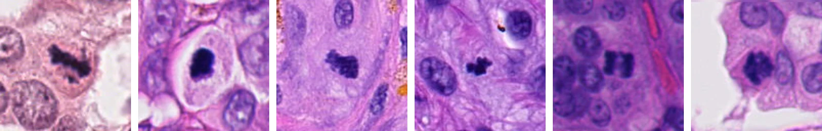 Six mitotic figures from MIDOG++ training slides: dark, condensed chromosomes in dividing cells.