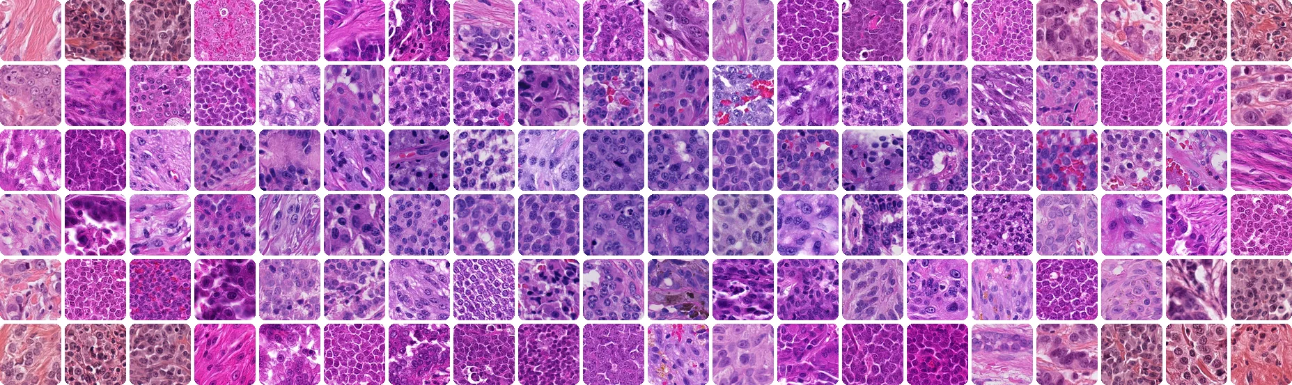 A mosaic of 120 tissue tiles from MIDOG++ training slides, sorted by stain color: violet at the center, pink at the edges.